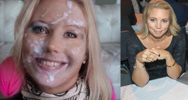 Before After Multiple Facials